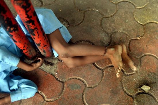 印度9歲殘障男孩被綁公交站鐵欄驕陽似火行人漠視[1]-