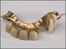 Churchill's dentures (c) Hunterian museum