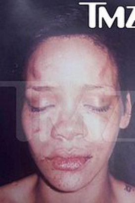 2009年布朗怒打蕾哈娜致伤