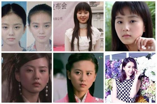 刘诗诗