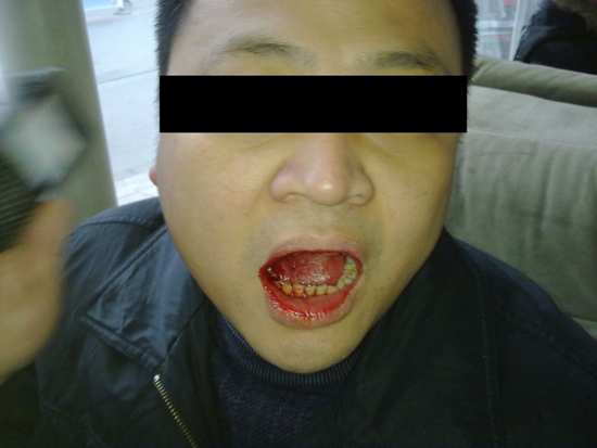 信阳凤凰新世界殴打业主见血_信阳房产