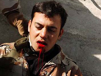 伊拉克士兵中枪子弹穿嘴而过仅造成皮肉伤