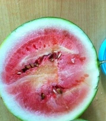 网传打针西瓜破坏肾功教你识别好坏西瓜