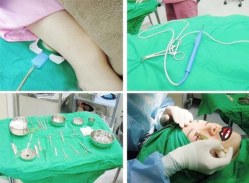 手术的各种器械和我