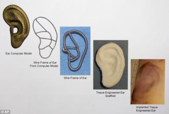 美科学家利用人类细胞培植出人造耳朵|整形|人