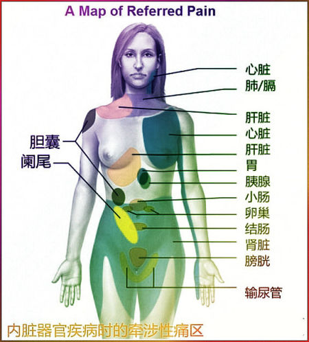 医生补充参考版:器官牵涉性痛区 医生补充参考版:器官牵涉性痛区