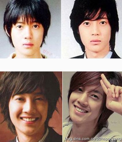 李多海具荷拉金贤重 韩国明星公开承认整容|金