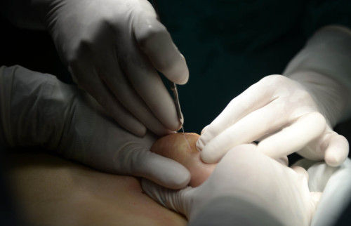 谈对象要不要跟自己的男朋友说自己隆过胸,现在的男人