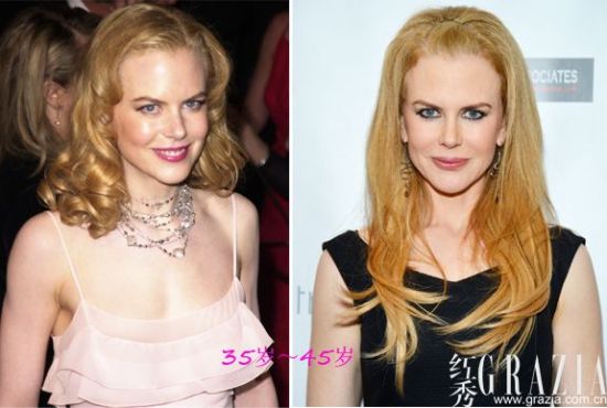 Nicole Kidman