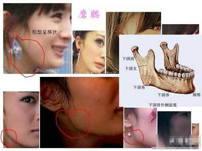 图揭杨幂变脸史嘴巴成婆婆嘴