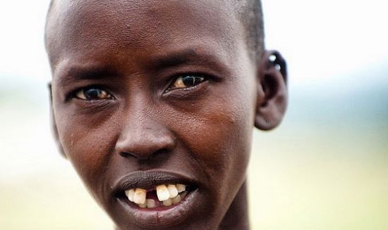 东非奇俗:马赛成年男人都少一颗门牙