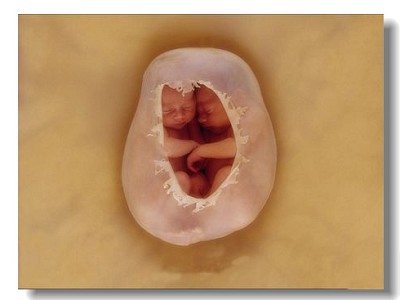 怀孕5个月胎儿图真实图片