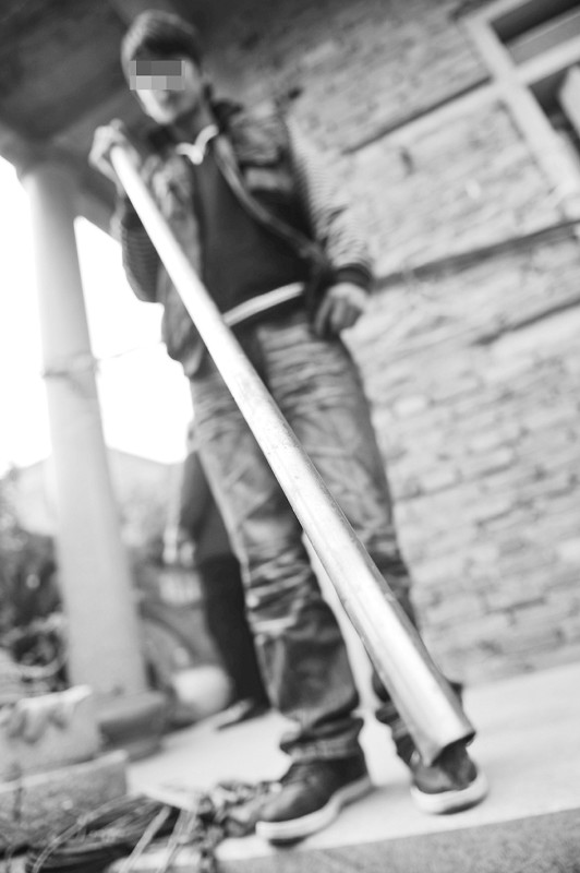 "村主任儿子用铁棍打我爸" 被打者头部四处受伤