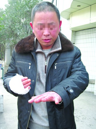 偷钱被发现,和失主打起来 两人都受伤,窃贼撇下摩托车跑了