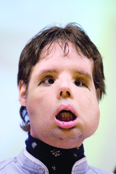 的西班牙男子26日出席新闻发布会,首度面对媒体摄像机镜头.