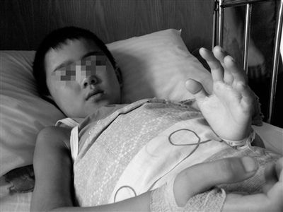 晾衣铁丝电倒八龄童经抢救已脱离生命危险