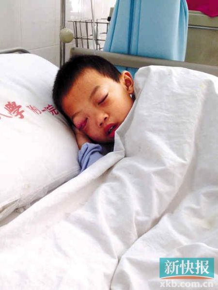 湖南男童罹患肿瘤两次手术后双目失明
