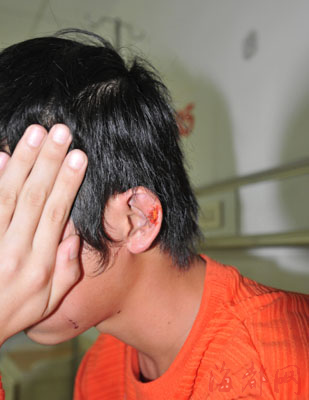 安溪:初二男生 校内被打成脑积血