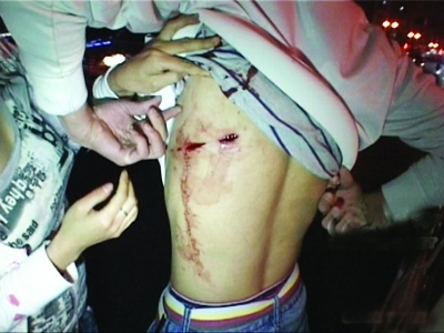 只因多看了她两眼小伙被捅一刀