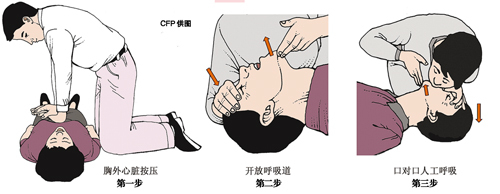 心跳骤停 新浪网