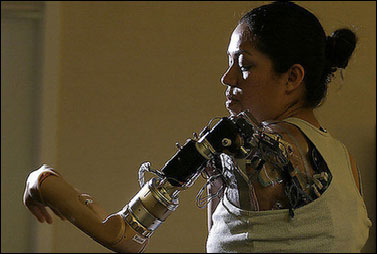 克劳迪娅·米歇尔安装的仿生手臂能够受思维支配.