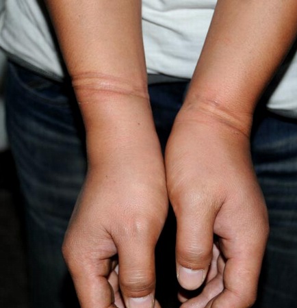 记者讲述:采访车祸被洛阳警察围殴打晕 警方调查