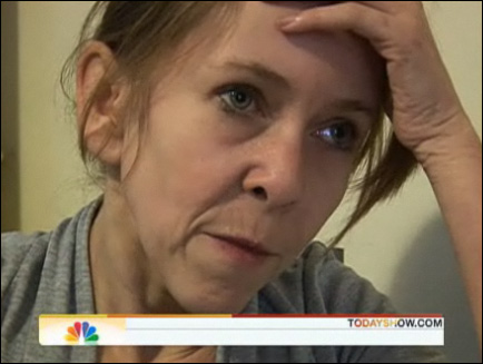 英国13岁女孩得怪病皮肤多褶皱看起来像50岁图