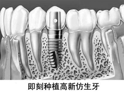什么原因导致的牙齿松动 1385519560_guhmuE.jpg