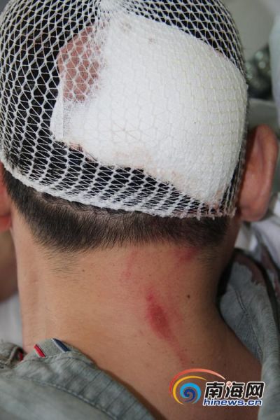 一个多小时醒来后满头是血,但随身携带的财物却并无丢失.