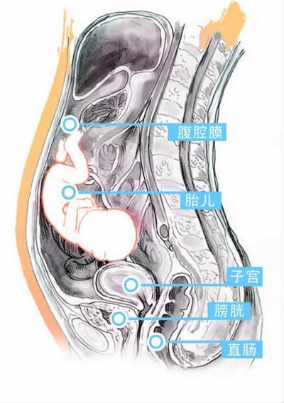 怀孕时子宫破裂胎儿连同胎盘滑入腹腔内 图/振宇