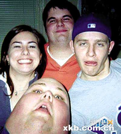 脑袋长得像拇指 男子红遍网络