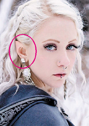 自认"前世是仙女"女子整形"精灵耳"