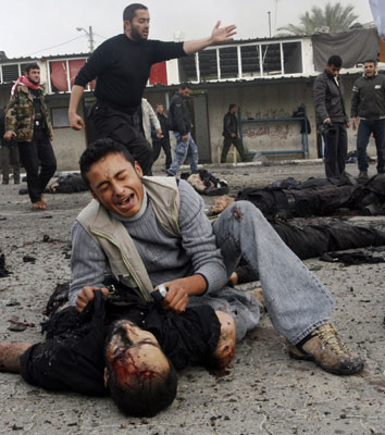 图文:空袭中的伤者