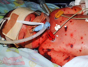 组图:英国截肢男孩身残志坚跳芭蕾