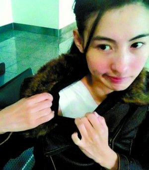 张柏芝虽然肩部包裹着白纱布,但她表情很坚强