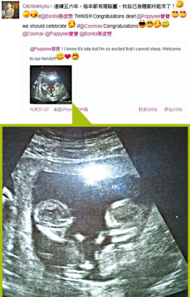 怀孕30天双胞胎b超图片图片