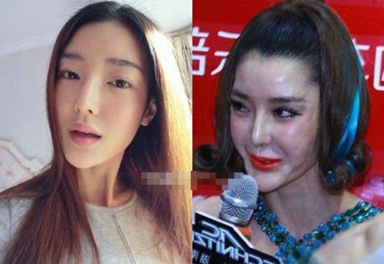 李小璐李穎芝盤點女星整容過度慘遭毀容