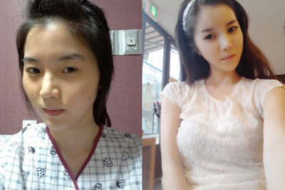 韩国女子整容前后对比照
