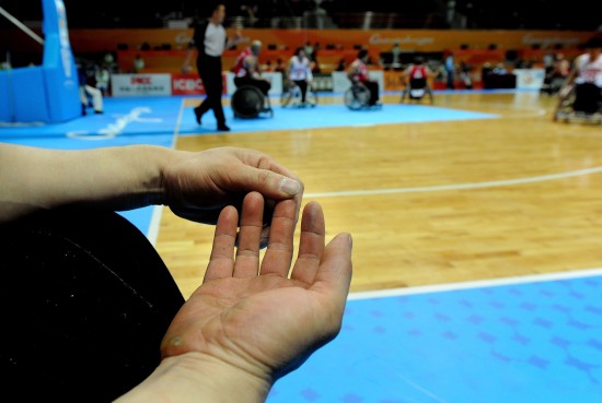 图文记录轮椅篮球队球员陈海江手上满是老茧