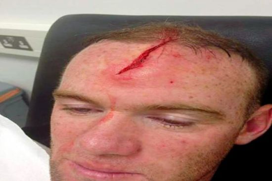 头部缝10针仍要提前复出 只为帮曼联战曼城